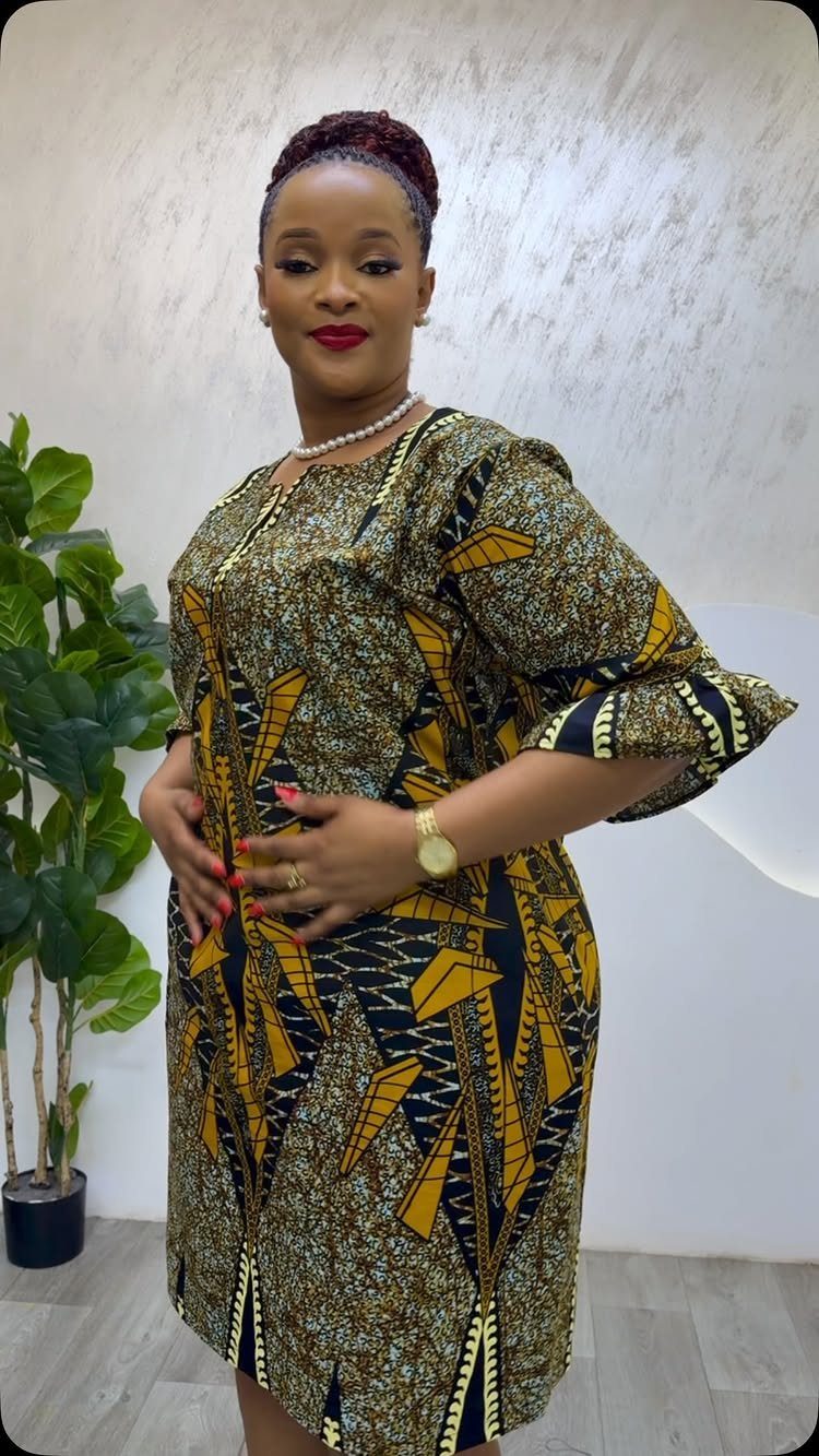 A woman posing in a patterned yellow and black loose-fitting shift dress.